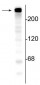 Anti-Alpha II Spectrin Antibody