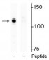 Anti-Androgen Receptor (Ser94) Antibody