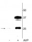 Anti-Aquaporin 2 (Ser264) Antibody