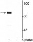 Anti-Synapsin I (Ser9) Antibody