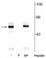 Anti-Tryptophan Hydroxylase (Ser260) Antibody