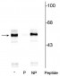 Anti-Tryptophan Hydroxylase (Ser260) Antibody