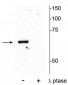Anti-PAK-1 (Thr84) Antibody