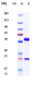 Anti-PTPRC / CD45 Reference Antibody (Novartis patent anti-CD45)