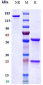Anti-TNFRSF5 / CD40 Reference Antibody (bleselumab)