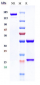 Anti-ERBB1 / EGFR / HER1 Reference Antibody (zalutumumab)