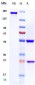 Anti-CD20 Reference Antibody (rituximab)