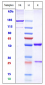 Anti-ERBB2 / HER2 / CD340 Reference Antibody (margetuximab)