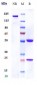 Anti-CSF2Rb / CD131 Reference Antibody (CSL311)