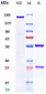 Anti-C1s Reference Antibody (sutimlimab)