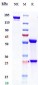 Anti-CD19 Reference Antibody (Loncastuximab tesirine)