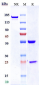 Anti-TNFRSF8 / CD30 Reference Antibody (brentuximab vedotin)