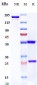 Anti-TNFRSF8 / CD30 Reference Antibody (brentuximab)