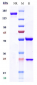 Anti-TNFRSF5 / CD40 Reference Antibody (selicrelumab)