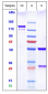 Anti-FOLR1 / FRA Reference Antibody (mirvetuximab-MMAE)