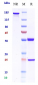 Anti-CSF2 / GM-CSF Reference Antibody (namilumab)