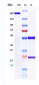 Anti-FcRn (FCGRT & B2M) Reference Antibody (nipocalimab)