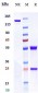 Anti-IGF1R / CD221 Reference Antibody (Lonigutamab-MMAE)