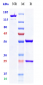 Anti-TIGIT Reference Antibody (vibostolimab)