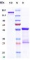 Anti-CCL2 / MCP1 Reference Antibody (carlumab)