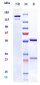Anti-OSMR Reference Antibody (vixarelimab)