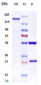 Anti-ROR1 Reference Antibody (zilovertamab)