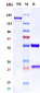 Anti-ROR1 Reference Antibody (zilovertamab vedotin)