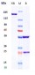 Anti-VEGFR2 / KDR / CD309 Reference Antibody (ramucirumab)