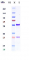 Anti-IFNg Reference Antibody (AMG 811)