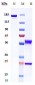 Anti-MMP9 Reference Antibody (andecaliximab)