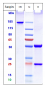 Anti-Amyloid Alpha Reference Antibody (birtamimab)
