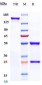 Anti-CALCA / CGRP Reference Antibody (eptinezumab)