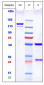 Anti-FZD Reference Antibody (vantictumab)