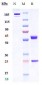 Anti-FZD10 Reference Antibody (tabituximab)