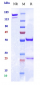 Anti-PCSK9 Reference Antibody (ralpancizumab)