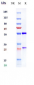 Anti-TPBG Reference Antibody (naptumomAb)