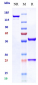 Anti-NGF / bNGF Reference Antibody (fasinumab)