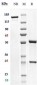 Anti-CD79b Reference Antibody (iladatuzumAb)