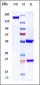 Anti-SLC40A1 Reference Antibody (LY2928057)