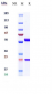 Anti-B7-H1 / PD-L1 / CD274 Reference Antibody (Lesabelimab)