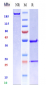 Anti-Fibronectin Reference Antibody (radretumab)