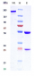 Anti-KLK2 / Kallikrein 2 Reference Antibody (JNJ-69086420)