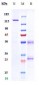 Anti-NGF / bNGF Reference Antibody (fulranumab)