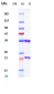 Anti-VEGFR2 / KDR / CD309 Reference Antibody (olinvacimab)