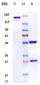 Anti-F3 / Factor III / Tissue Factor / CD142 Reference Antibody (tisotumab)
