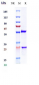 Anti-CD20 Reference Antibody (ofatumumab)