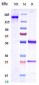 Anti-CD20 Reference Antibody (zuberitamab)