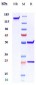 Anti-Amyloid Beta Reference Antibody (GSK 933776)