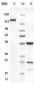 Anti-AMHR2 Reference Antibody (murlentamab)