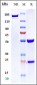 Anti-VEGFR2 / KDR / CD309 Reference Antibody (vulinacimab)